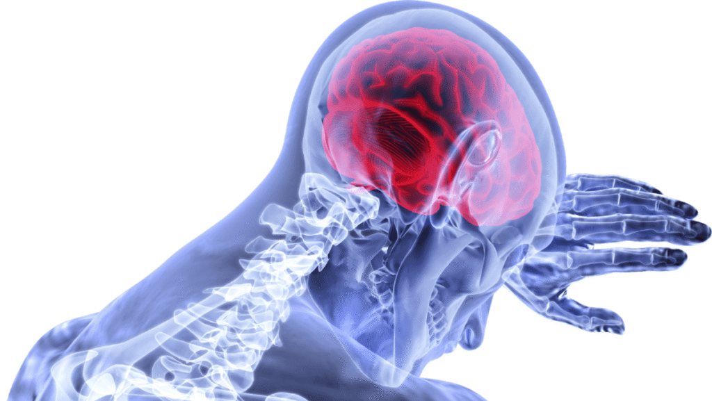 concussion treatment