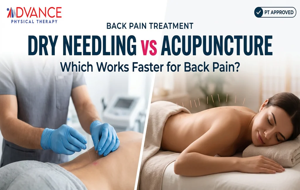 Dry Needling vs Acupuncture