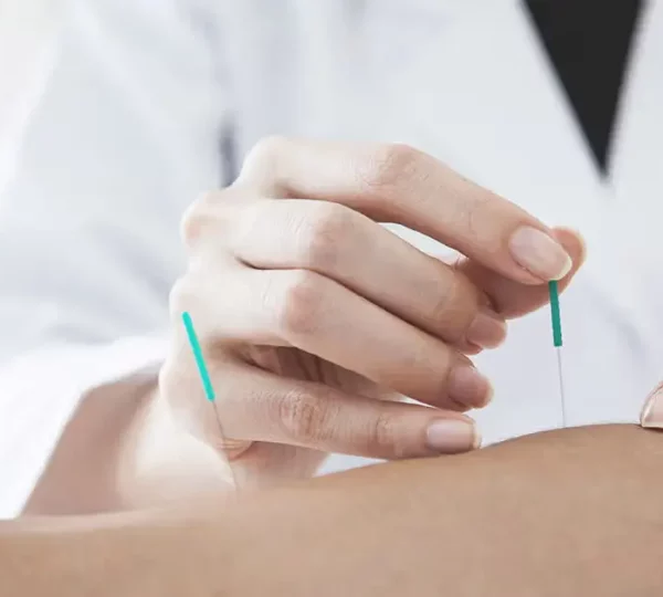 1200x628_FACEBOOK_-Dry_Needling_vs._Acupuncture_Which_Is_Right_for_You-1200x628-1